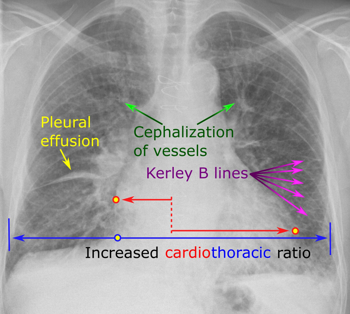 pain-in-left-side-of-chest-general-center-steadyhealth