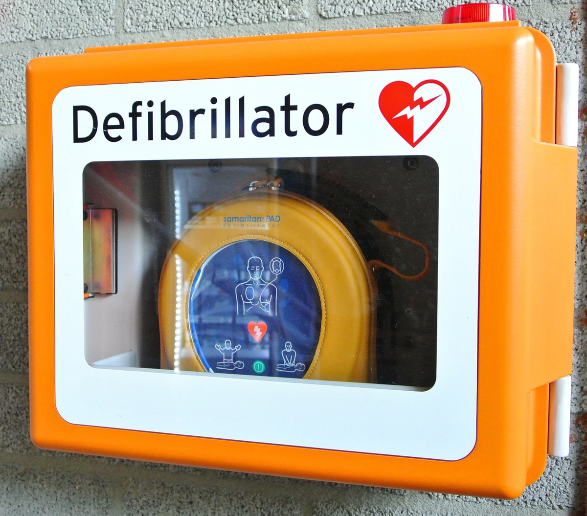 defibrillator-implant-surgery-general-center-steadyhealth