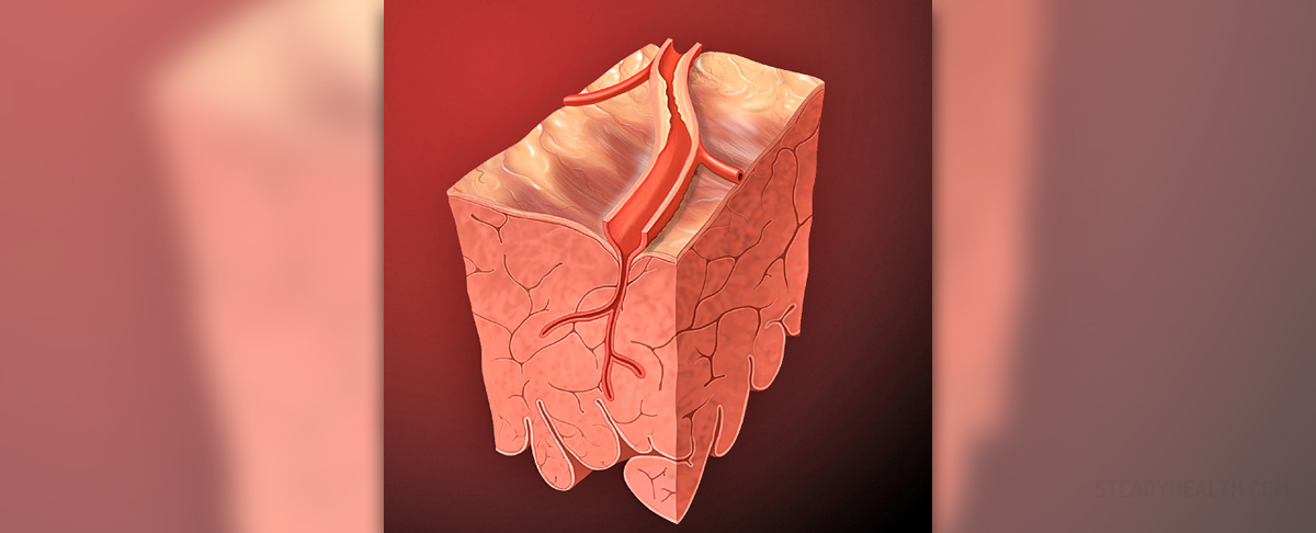 hypertensive-heart-disease-general-center-steadyhealth