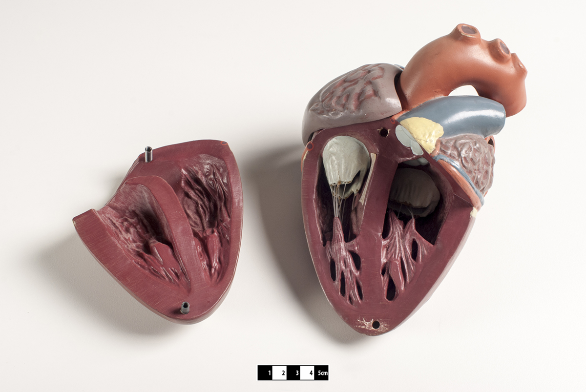 Causes of cardiovascular disease | General center | SteadyHealth.com