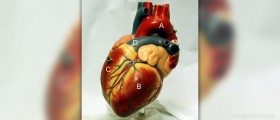 Heart transplant cost
