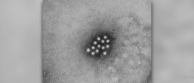 Hepatitis A: Symptoms in children