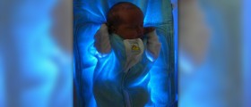 Herbs for jaundice