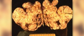 Herbs for ovarian cancer