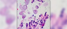 Herbs for ulcerative colitis