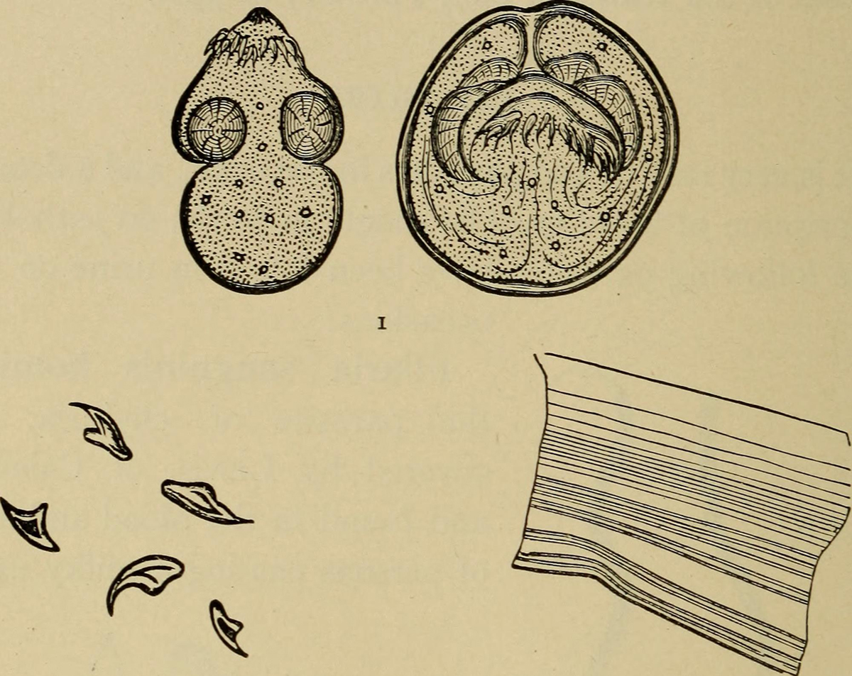 high-levels-of-protein-in-urine-general-center-steadyhealth