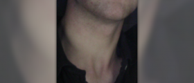 Home neck traction