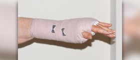 Home treatment for carpal tunnel