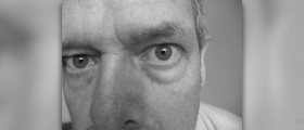 Home treatment for dark circles under eyes