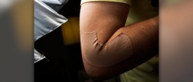 Home treatment for tennis elbow
