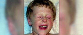 Homeopathic remedies for allergies
