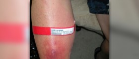 Homeopathic remedies for infection
