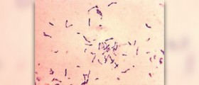 Homeopathic remedy for diphtheria