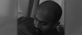 Hormonal imbalance and baldness