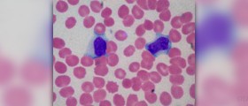 Hospital infections review