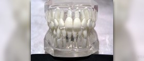 How a good oral hygiene and teeth care can prolong your life
