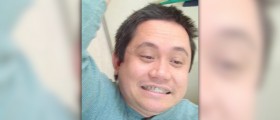 How do braces work