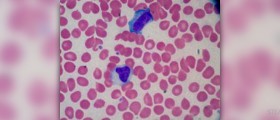 How long does mononucleosis last