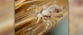 How to kill lice