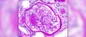 How to prevent diabetic foot from gangrene