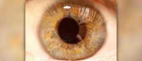 How to put contacts in your eyes
