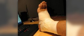 How to treat a sprained foot