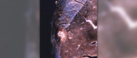 How to treat an abscess