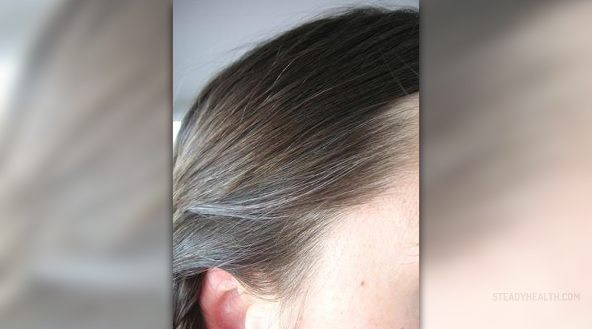 How To Treat Grey Hair General Center Steadyhealth Com