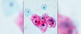 HPV treatment for women