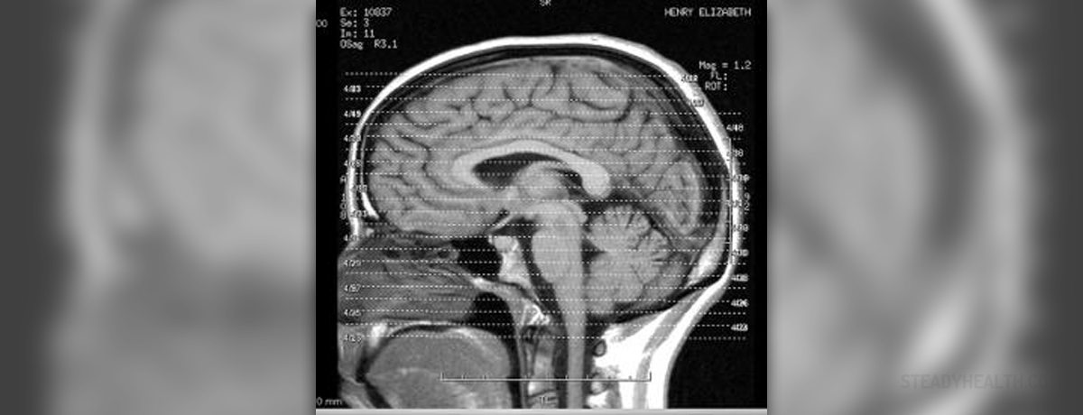 Human brain diagram | General center | SteadyHealth.com