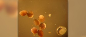 Embryo Mix-Up : Is It Possible?