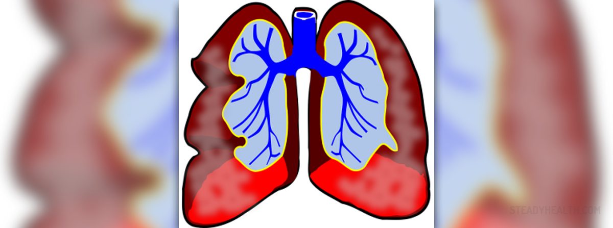 Lung disease types | Respiratory tract disorders and diseases articles