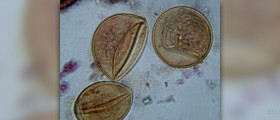 Human tapeworm - intestinal parasite infection