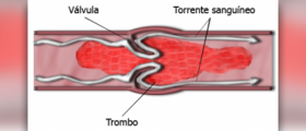 Improve blood circulation
