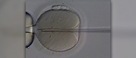 Miscarriage after IVF