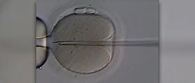Mini IVF: another option to consider when you need fertility treatment