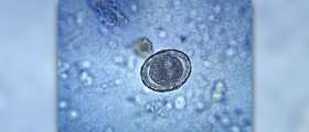 Increase fertility over 40