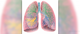 Inflammation of the lungs
