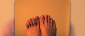 Ingrown toenail surgery