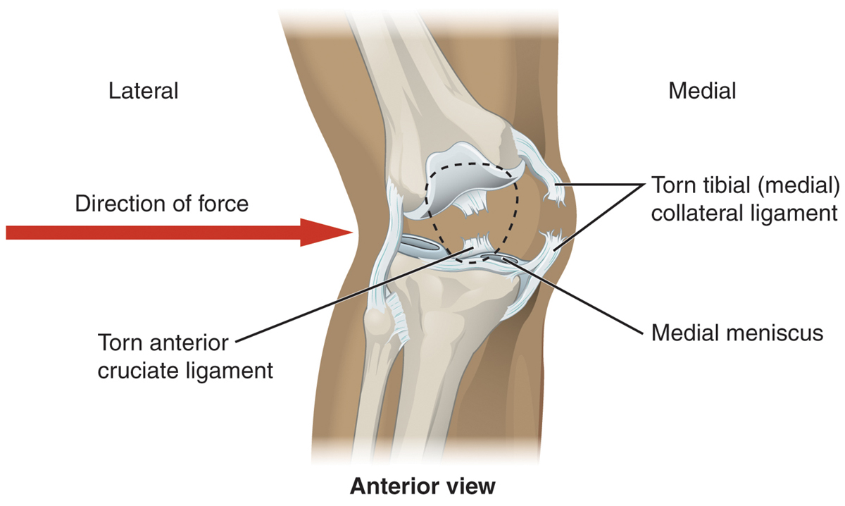 knee-pain-when-running-general-center-steadyhealth