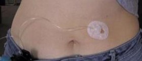 Insulin resistance diet