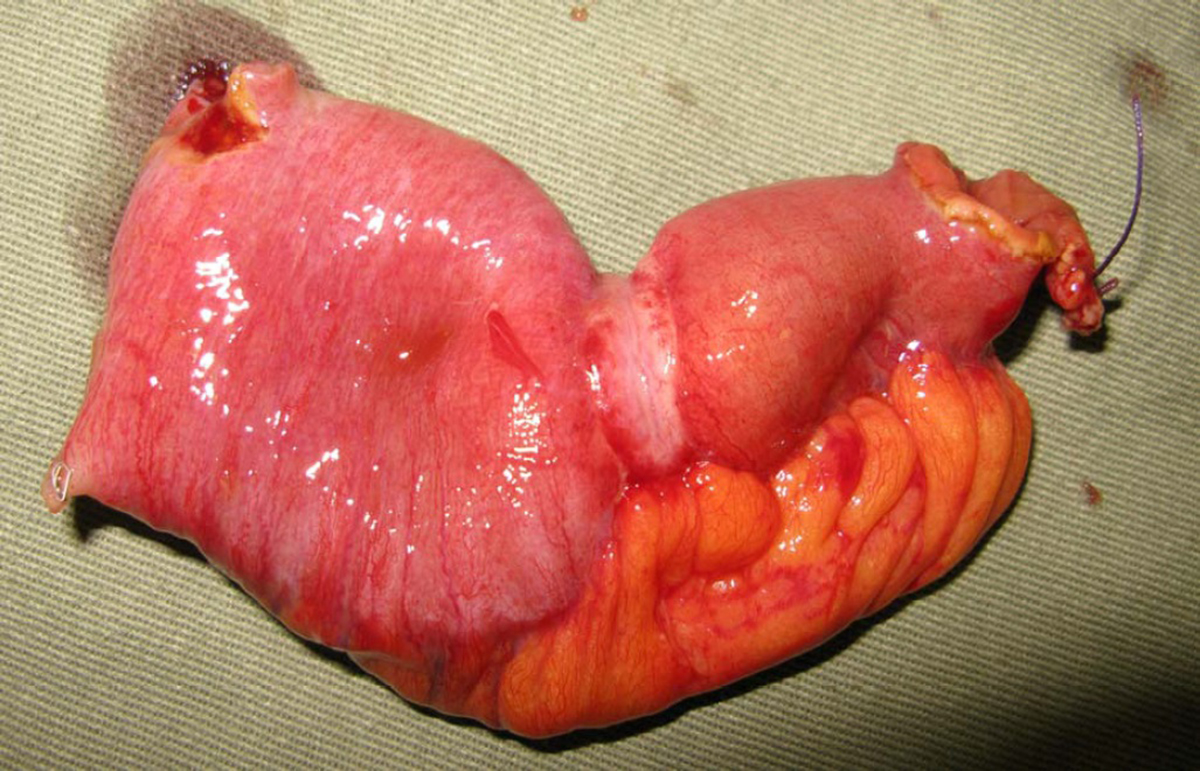 Causes of malabsorption | General center | SteadyHealth.com