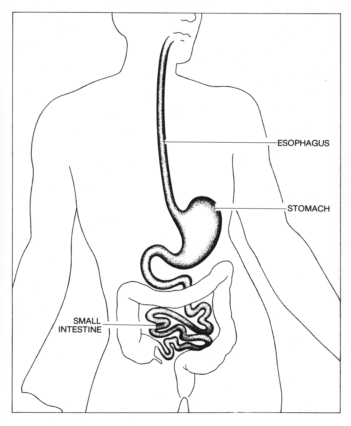 Chronic bowel obstruction | General center | SteadyHealth.com