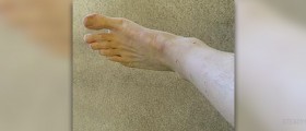 Ionic foot bath - Foot detox