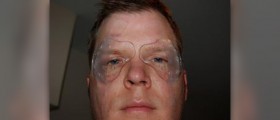 Is LASIK eye surgery the right choice for you?