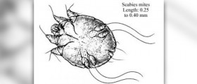 Is scabies contagious