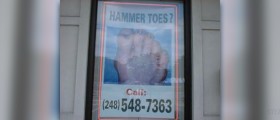 Is there a cure for Hammer toe