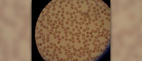 Is there a cure for malaria