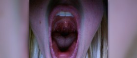 Itchy sore throat