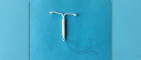 Intrauterine devices halve risk of cervical cancer: new study